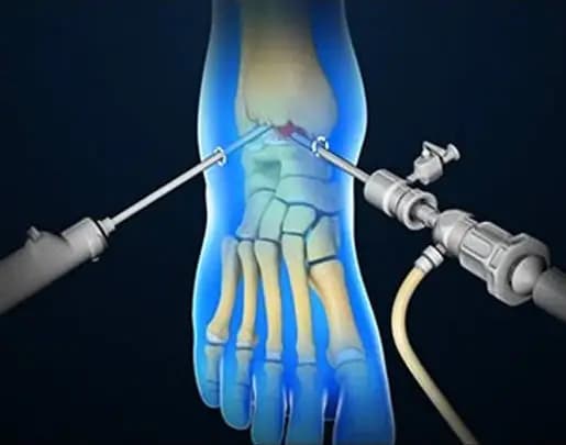 Eklem Faresi Cerrahisi