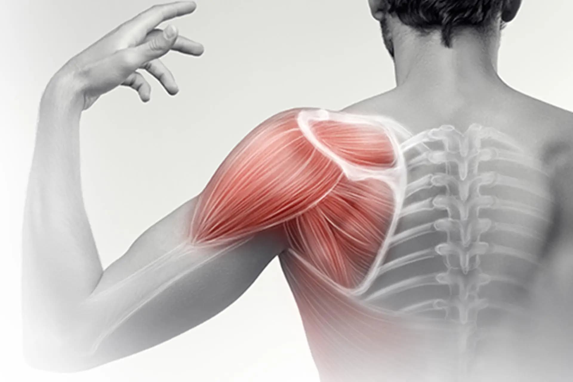 Omuz Kireçlenmesi Tedavisi