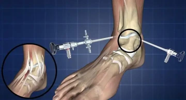 Mozaikoplasti Nedir?