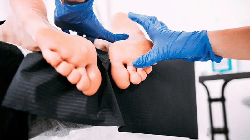 What Causes Foot Deformities? What Are the Symptoms?