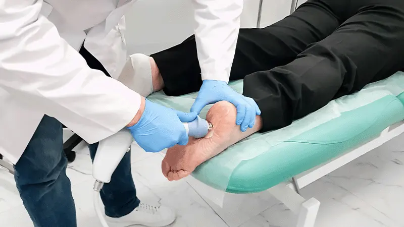 What Are the Most Common Foot Deformities?