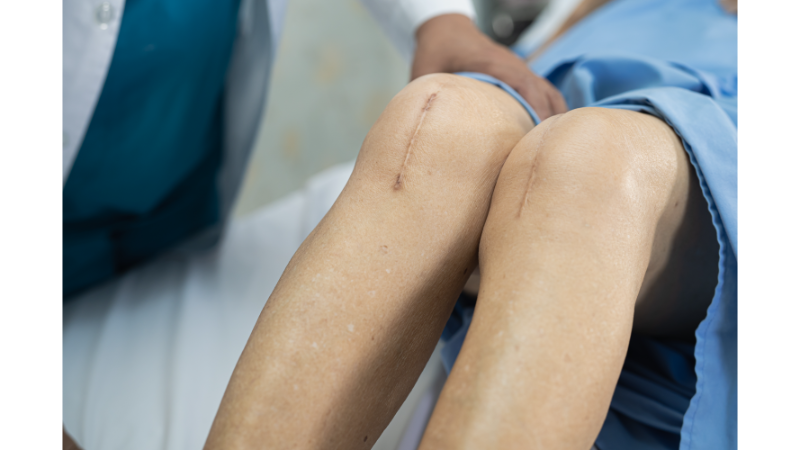 Çapraz Bağ Kopmasının Nedenleri