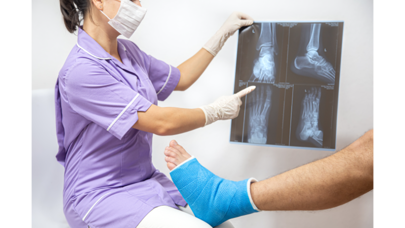 What Is Bone Marrow Edema?